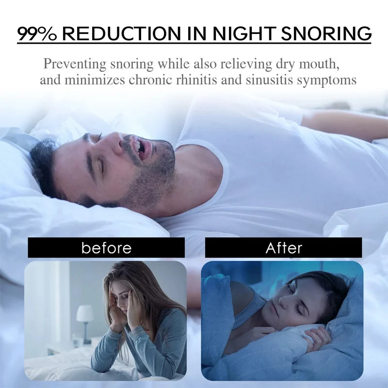 Mouth Tape for Better Sleep – 90/60/30 Pcs Gentle Strips to Prevent Snoring, Keep Mouth Closed & Reduce Dryness (Perfect for Home or Travel)